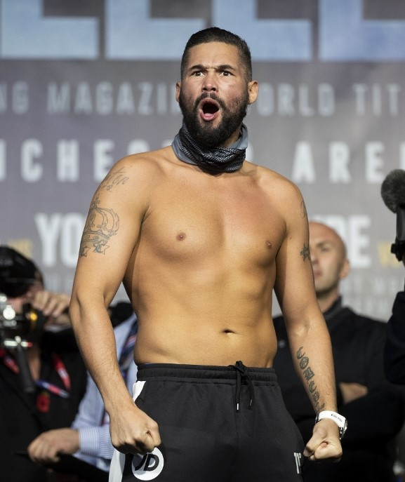Tony Bellew